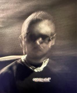 MR