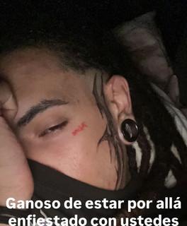 PP