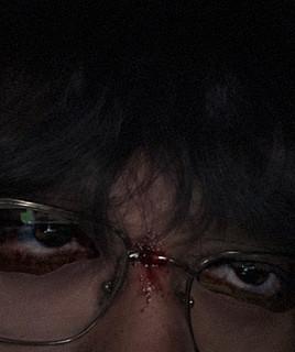 O