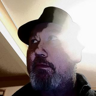 MR