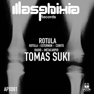 Rótula