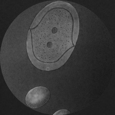 CNR005B